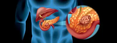 Retiran estudio sobre cáncer de páncreas por conflicto de intereses