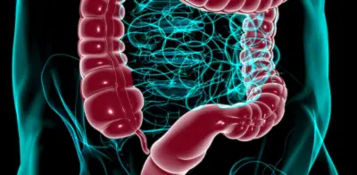 Sangrado al evacuar: síntoma clave que podría indicar cáncer de colon según especialista