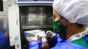Autoridades confirman primer caso de peligrosa variante de viruela del mono en Envigado, Antioquia