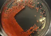 La ciencia detrás de las lágrimas rojas en estatuas religiosas: bacterias, no milagros