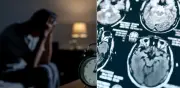 Mala higiene del sueño: vínculo directo con Alzheimer, depresión y ansiedad según expertos