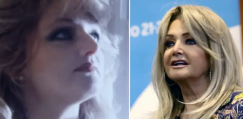 Bonnie Tyler hospitalizada en Portugal tras cirugía intestinal: su estado de salud