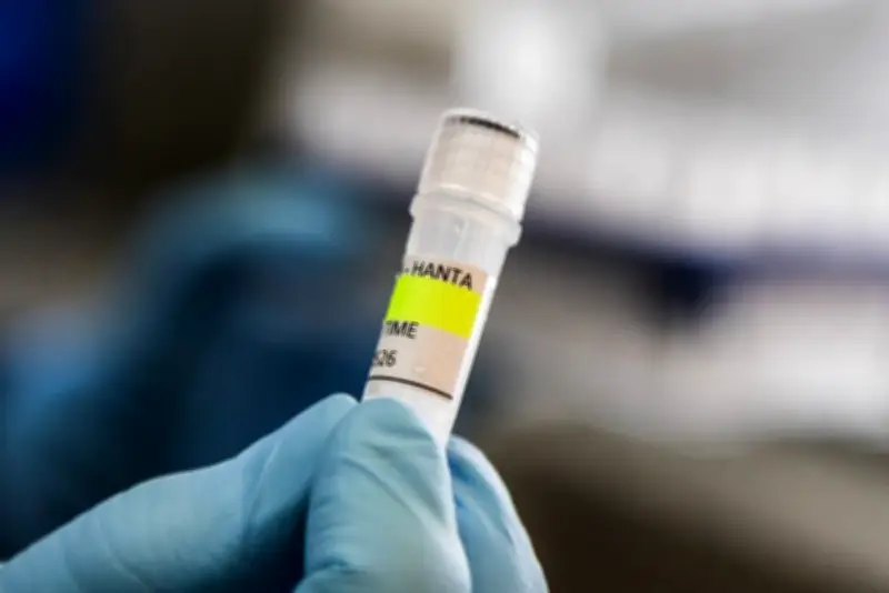 Colombia sin casos de hantavirus: aclaración del Ministerio de Salud