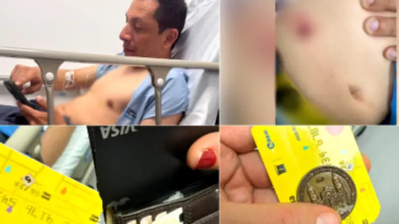 Funcionario del MinInterior herido al intentar evitar un atraco en Bogotá