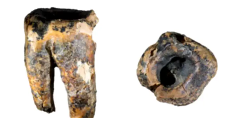 Hallan diente neandertal con caries tratada hace 59.000 años