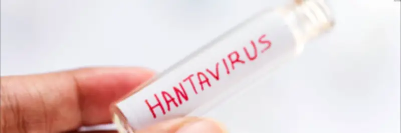 Hantavirus en Colombia: expertos piden vigilancia sin alarma