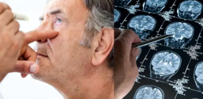Los ojos podrían revelar inicios de Parkinson y Alzheimer: avances en estudios