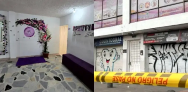 Mujer denuncia grave infección tras lipo láser en centro donde desapareció Yuliza Toloza
