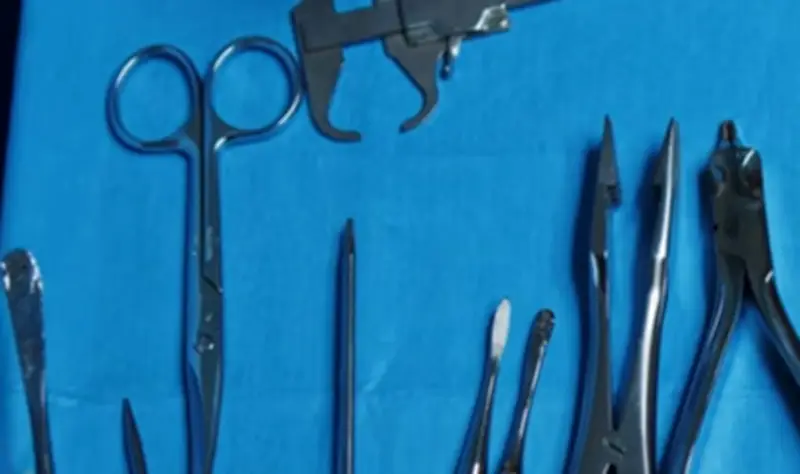 Mujer vivió siete meses con tijeras quirúrgicas en el abdomen tras cirugía estética en Italia