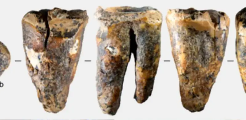 Neandertales perforaban dientes infectados hace 59.000 años