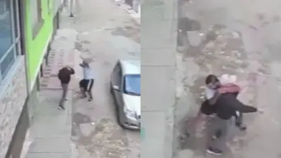 Adulto mayor con fractura facial tras brutal golpiza en Engativá