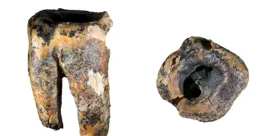 Hallan diente neandertal con caries tratada hace 59.000 años