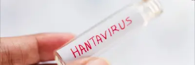Hantavirus en Colombia: expertos piden vigilancia sin alarma