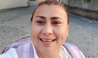 Medicina Legal revela causa de muerte de Yulixa Toloza tras lipólisis láser