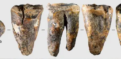 Neandertales perforaban dientes infectados hace 59.000 años