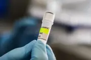 Colombia sin casos de hantavirus: aclaración del Ministerio de Salud