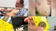Funcionario del MinInterior herido al auxiliar a ciclista en Bogotá