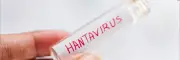 Hantavirus en Colombia: expertos piden vigilancia sin alarma