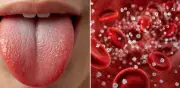 ¿Puede la boca advertir diabetes antes del diagnóstico? Señales clave