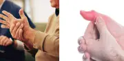 Señales tempranas de artritis que ignoras y cómo prevenirla