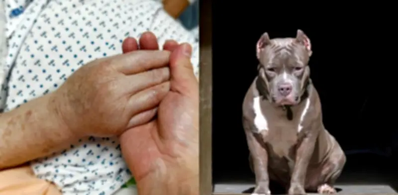 Ataque brutal de perros en Montebello: mujer perdió dos dedos
