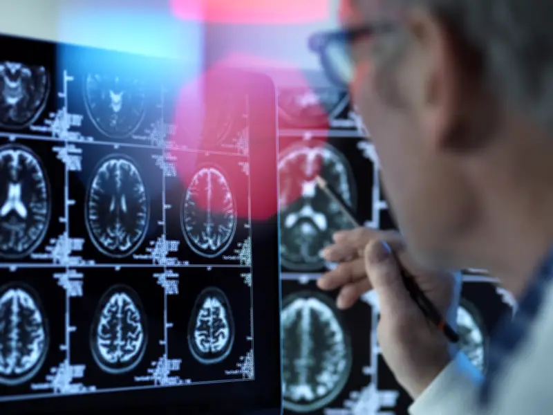 Diferencia entre tumor cerebral y cáncer cerebral: síntomas y tratamiento