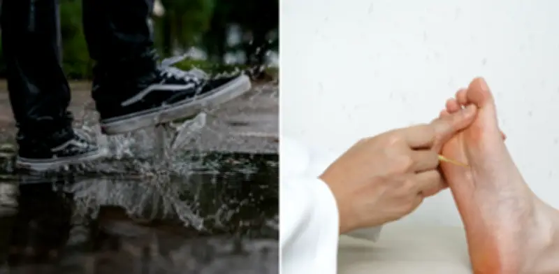 ¿Es peligroso pisar charcos de lluvia? Expertos responden sobre hongos y humedad