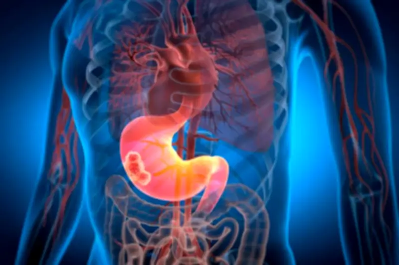 Nuevo medicamento experimental duplica supervivencia en cáncer de páncreas