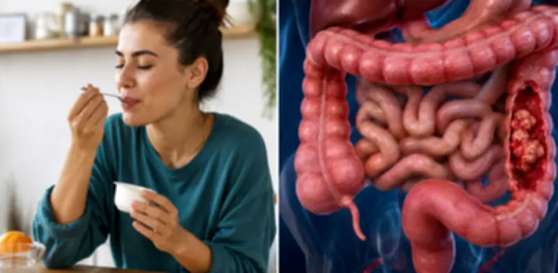 Yogur reduce riesgo de cáncer de colon hasta 20% según estudios