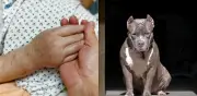 Ataque brutal de perros en Montebello: mujer perdió dos dedos