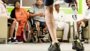 Prótesis deportivas: la revolución tecnológica que transforma vidas en Colombia