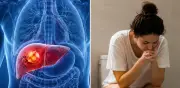 Señales en el baño que alertan sobre cáncer de hígado